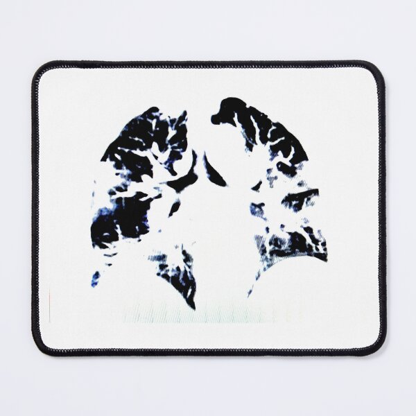 Item preview, COVID-19 Pneumonitis - CT Scan of the Chest designed and sold by Creative Endeavors ..