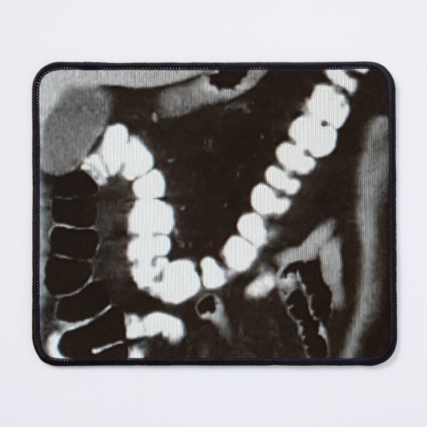 Item preview, Abdominal CT Scan designed and sold by Creative Endeavors ..