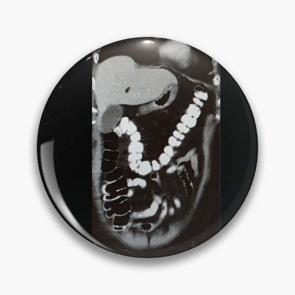Item preview, Abdominal CT Scan designed and sold by Creative Endeavors ..