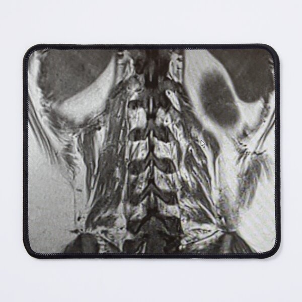 Item preview, Lumbar Lumbar Paraspinous Muscles with Lower Lungs, Liver and Spleen designed and sold by Creative Endeavors ..