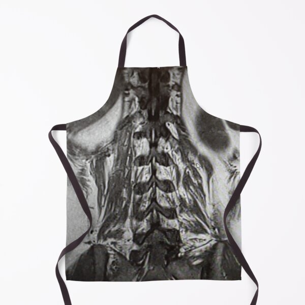 Item preview, Lumbar Lumbar Paraspinous Muscles with Lower Lungs, Liver and Spleen designed and sold by Creative Endeavors ..
