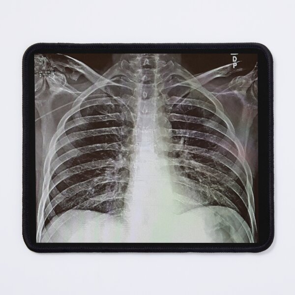 Item preview, Chest X-Ray designed and sold by Creative Endeavors ..