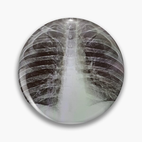 Item preview, Chest X-Ray designed and sold by Creative Endeavors ..