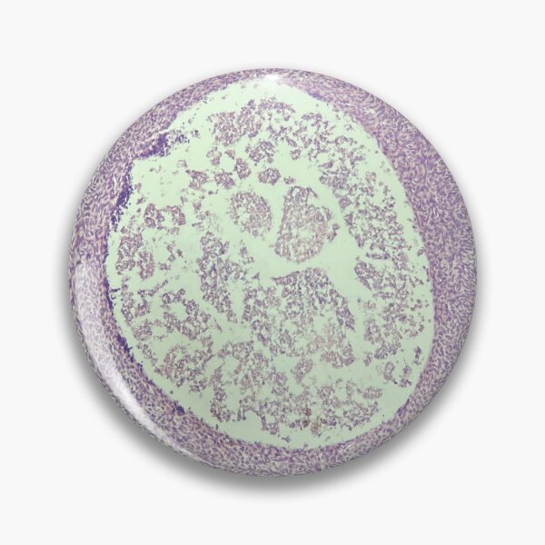 Item preview, Skin cyst under the microscope - histology designed and sold by CellPathWorld.