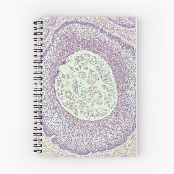 Item preview, Skin cyst under the microscope - histology designed and sold by CellPathWorld.