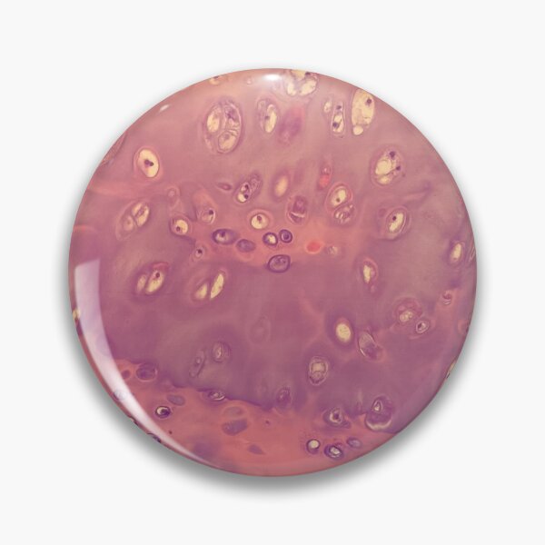 Item preview, Chondrocytes under the microscope - histology of the lung designed and sold by CellPathWorld.