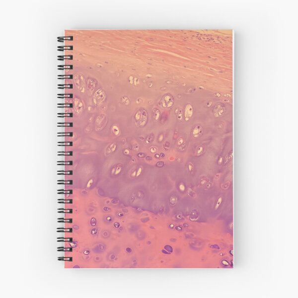 Item preview, Chondrocytes under the microscope - histology of the lung designed and sold by CellPathWorld.