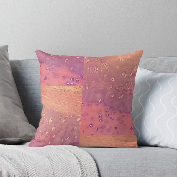 Item preview, Chondrocytes under the microscope - histology of the lung designed and sold by CellPathWorld.