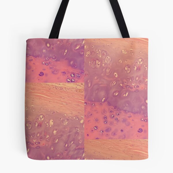 Item preview, Chondrocytes under the microscope - histology of the lung designed and sold by CellPathWorld.