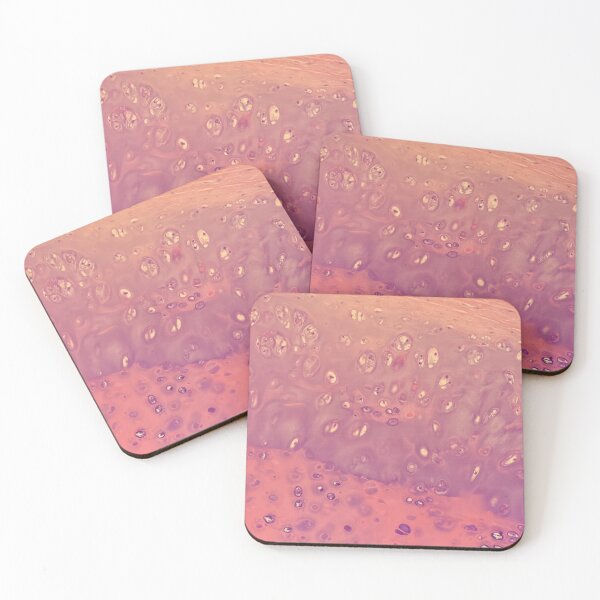 Item preview, Chondrocytes under the microscope - histology of the lung designed and sold by CellPathWorld.