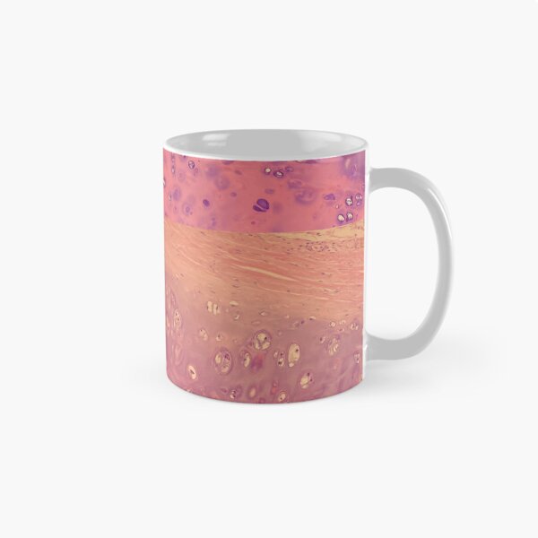 Item preview, Chondrocytes under the microscope - histology of the lung designed and sold by CellPathWorld.