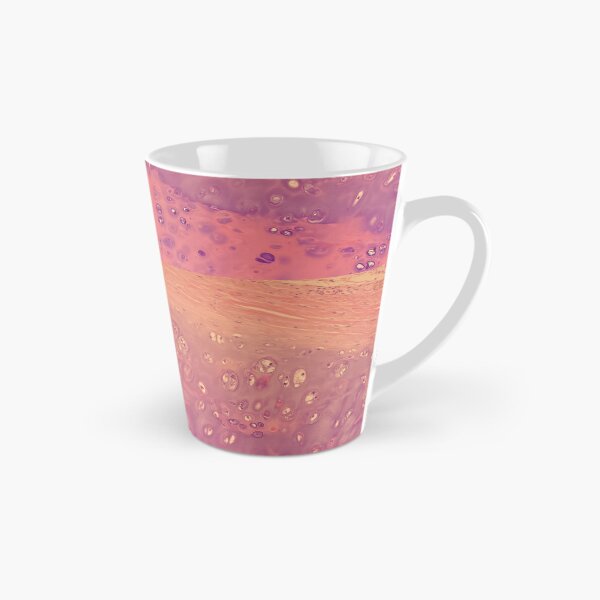 Item preview, Chondrocytes under the microscope - histology of the lung designed and sold by CellPathWorld.