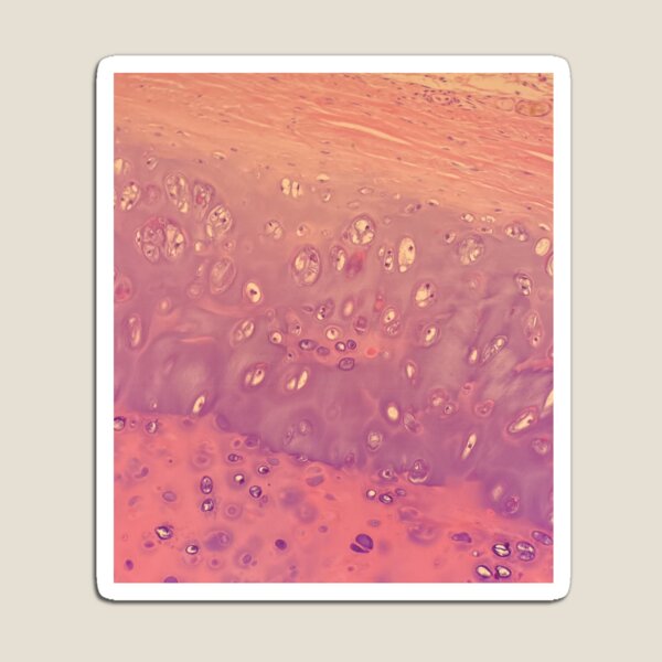 Item preview, Chondrocytes under the microscope - histology of the lung designed and sold by CellPathWorld.