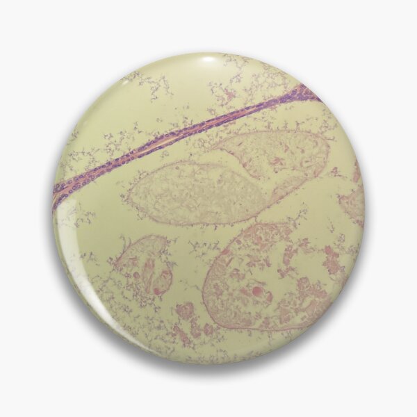 Item preview, Prostate glands under the microscope - histology designed and sold by CellPathWorld.