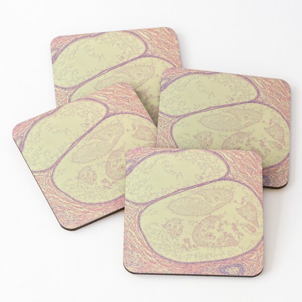 Item preview, Prostate glands under the microscope - histology designed and sold by CellPathWorld.