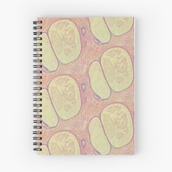 Item preview, Prostate glands under the microscope - histology designed and sold by CellPathWorld.