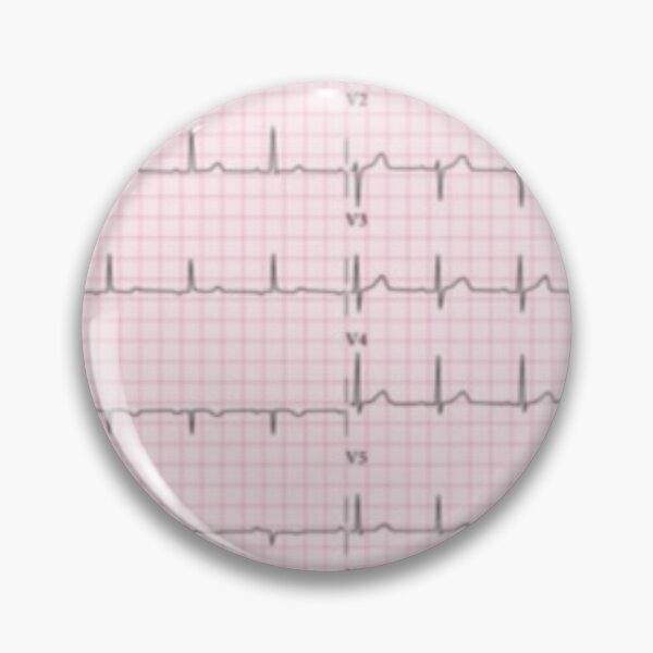 Item preview, ECG : electrocardiogram of the heart designed and sold by Boby Karnlen.