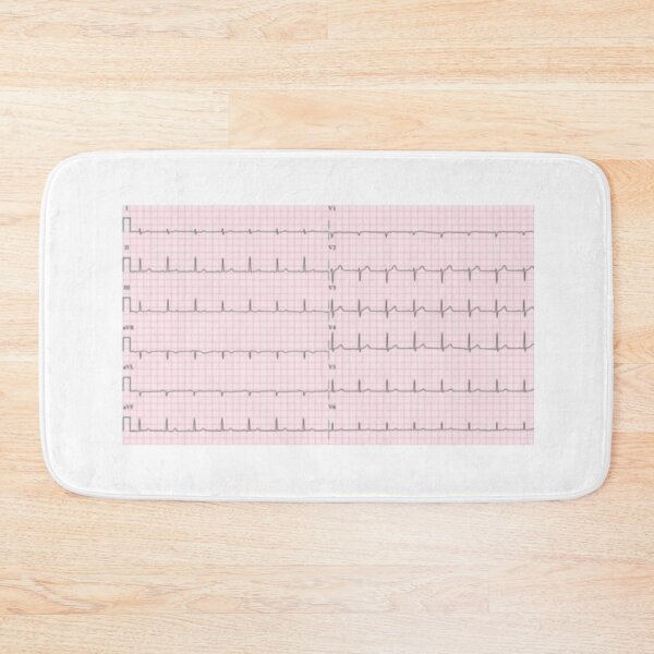 Item preview, ECG : electrocardiogram of the heart designed and sold by Boby Karnlen.