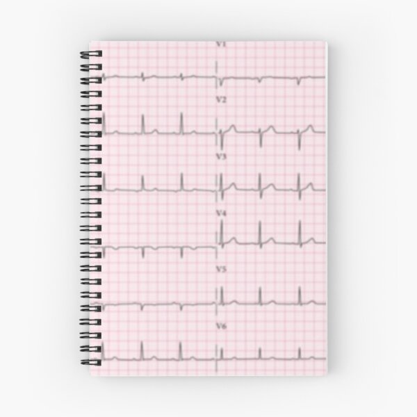 Item preview, ECG : electrocardiogram of the heart designed and sold by Boby Karnlen.