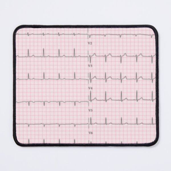 Item preview, ECG : electrocardiogram of the heart designed and sold by Boby Karnlen.