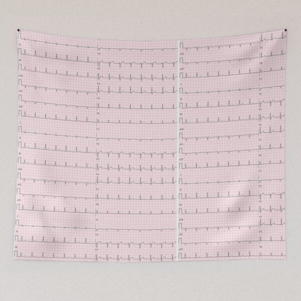 Item preview, ECG : electrocardiogram of the heart designed and sold by Boby Karnlen.