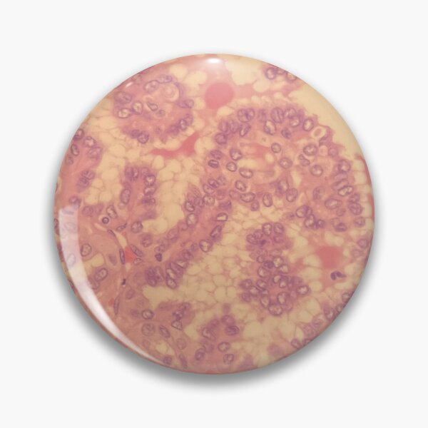 Item preview, Prostate cells under the microscope - histology designed and sold by CellPathWorld.