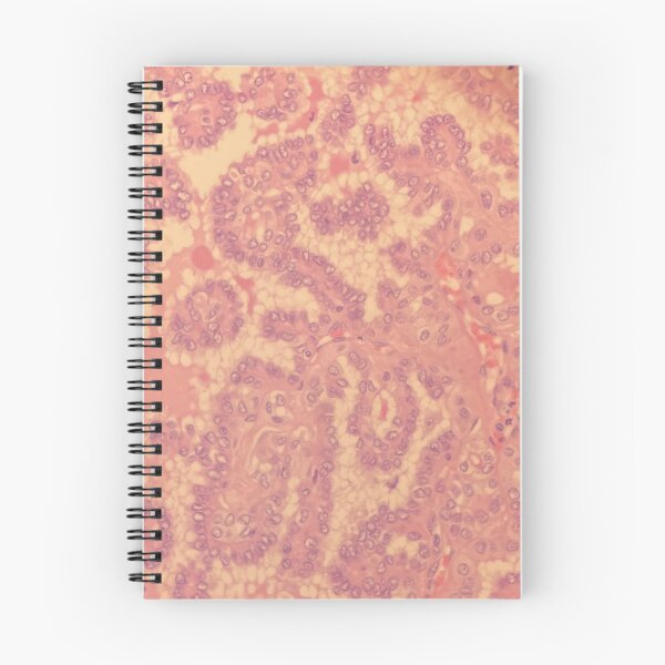 Item preview, Prostate cells under the microscope - histology designed and sold by CellPathWorld.
