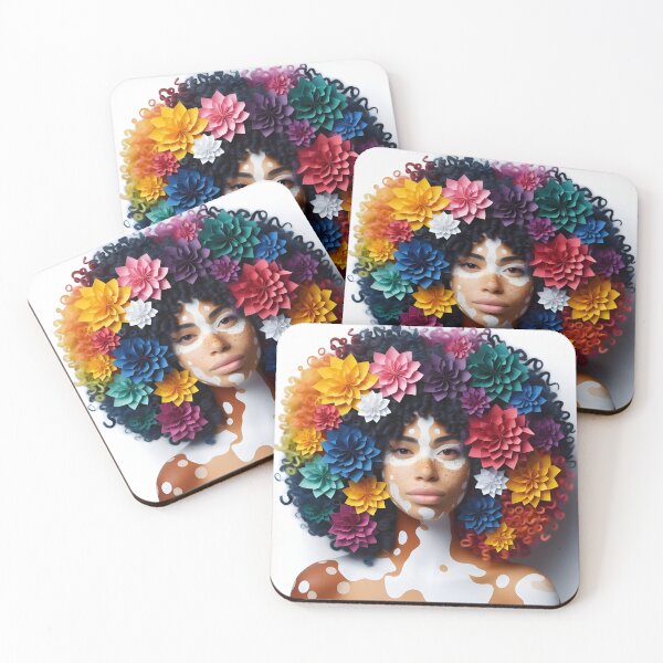 Item preview, Radiance in Uniqueness: Embracing Vitiligo Beauty designed and sold by TheBurntPencil.