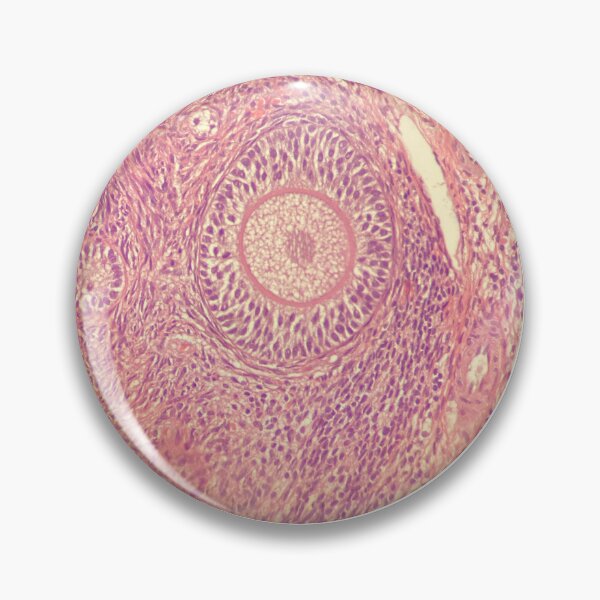 Item preview, secondary oocyte  designed and sold by rosipos.
