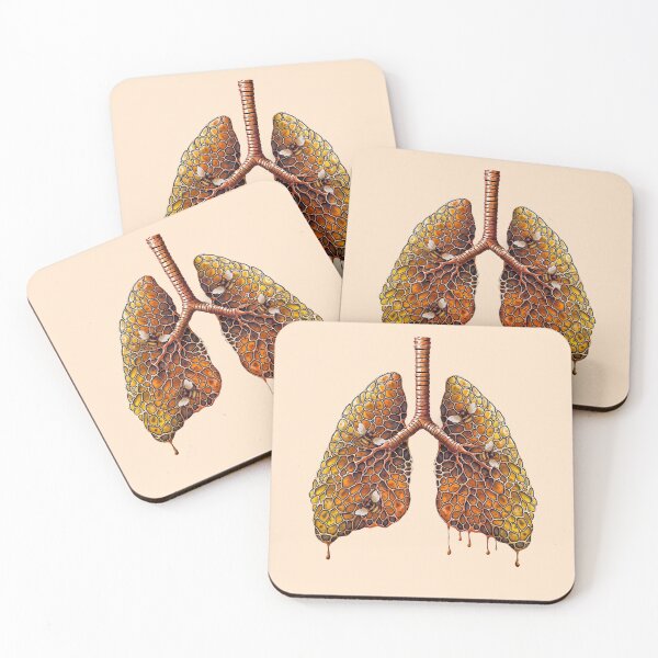 Item preview, Lungs honey beehive, honeycombs, bees,lungs cancer, Breathe, respiratory therapist designed and sold by Collagedream.