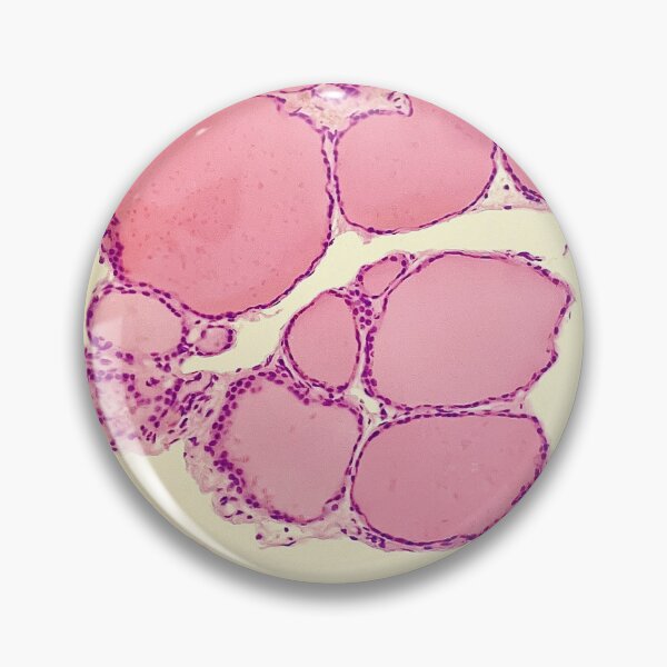 Item preview, Thyroid (with colloids) - histology  designed and sold by CellPathWorld.