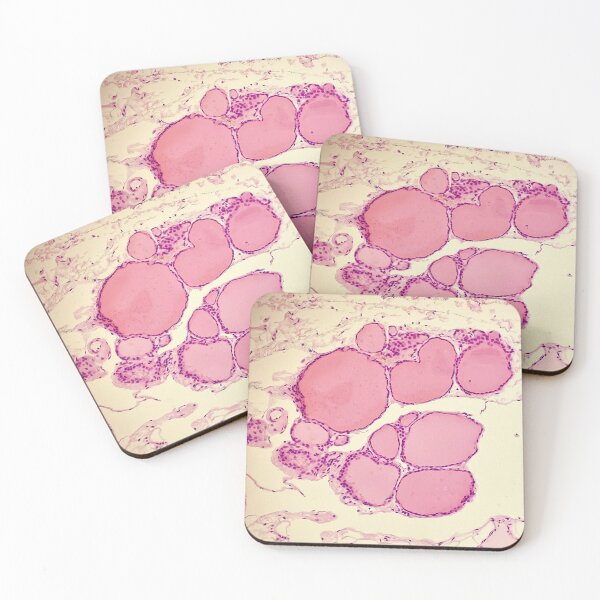 Item preview, Thyroid (with colloids) - histology  designed and sold by CellPathWorld.