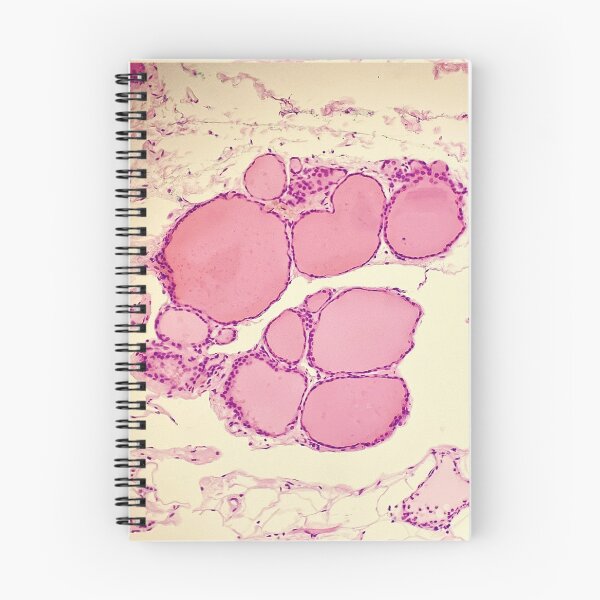 Item preview, Thyroid (with colloids) - histology  designed and sold by CellPathWorld.