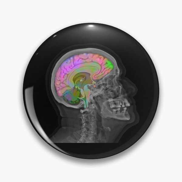 Item preview, Skull and Brain designed and sold by Naneyart.