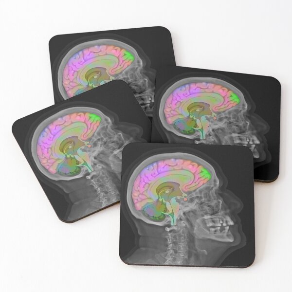 Item preview, Skull and Brain designed and sold by Naneyart.