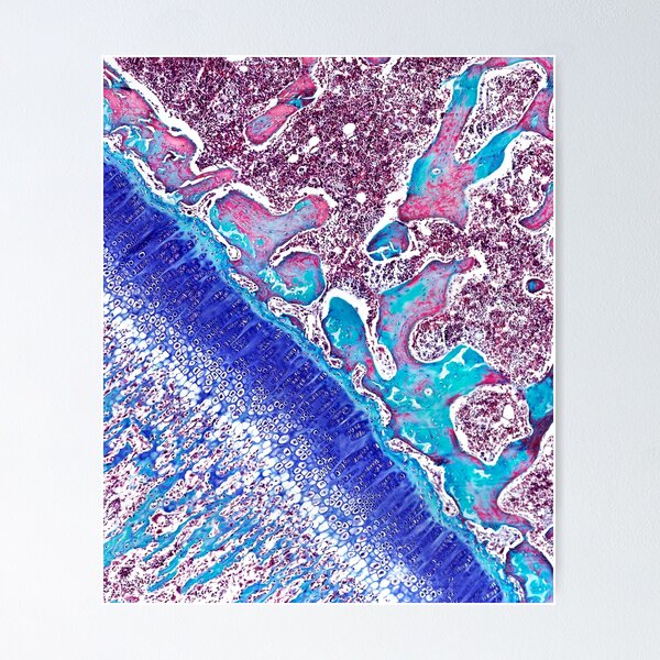 Item preview, Epiphyseal growth plate, light micrograph (C024/0125) designed and sold by SciencePhoto.