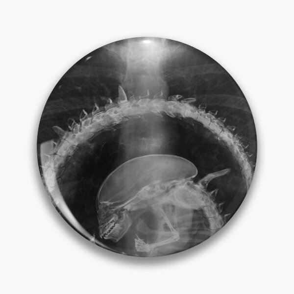 Item preview, Alien radiography Alien X-ray designed and sold by TyheimMejia.