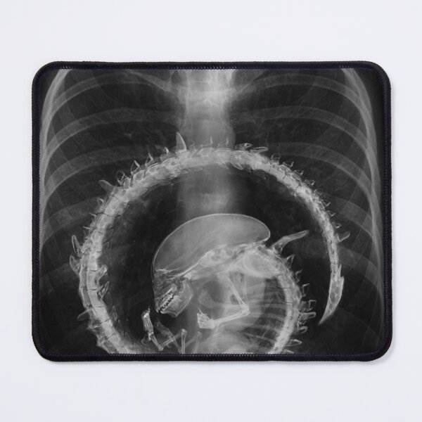 Item preview, Alien radiography Alien X-ray designed and sold by TyheimMejia.