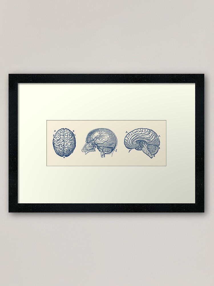 Alternate view of Brain Diagram - Three Views - Vintage Anatomy Framed Art Print