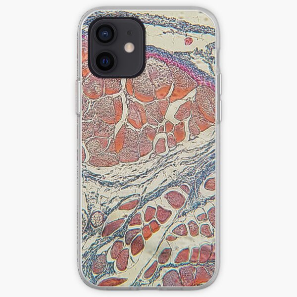 Anatomy iPhone Soft Case