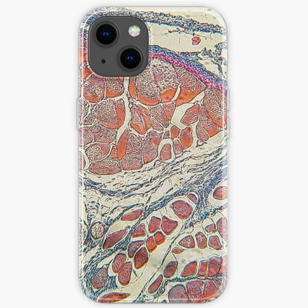 Anatomy iPhone Soft Case