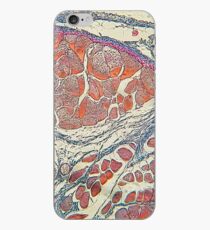Anatomy iPhone Case