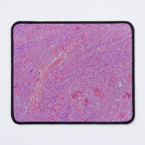 Item preview, Histology of fibrous tissue, lung, human tissue, H&E, 20x designed and sold by Psymier.