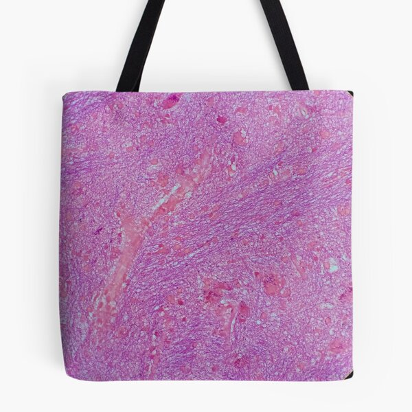 Item preview, Histology of fibrous tissue, lung, human tissue, H&E, 20x designed and sold by Psymier.