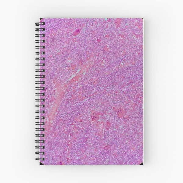 Item preview, Histology of fibrous tissue, lung, human tissue, H&E, 20x designed and sold by Psymier.