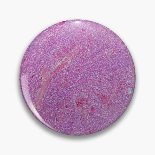 Item preview, Histology of fibrous tissue, lung, human tissue, H&E, 20x designed and sold by Psymier.