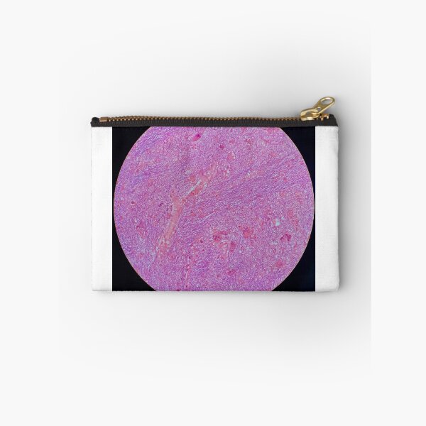 Item preview, Histology of fibrous tissue, lung, human tissue, H&E, 20x designed and sold by Psymier.