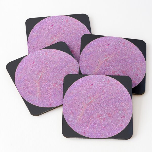 Item preview, Histology of fibrous tissue, lung, human tissue, H&E, 20x designed and sold by Psymier.
