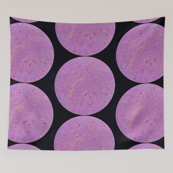 Item preview, Histology of fibrous tissue, lung, human tissue, H&E, 20x designed and sold by Psymier.