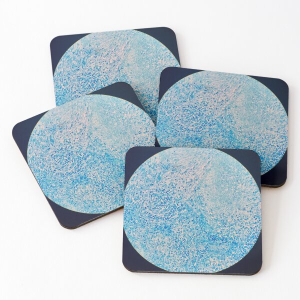 Item preview, Histology of Tuberculosis of the lung, TB, human tissue, Ziehl-Neelsen stain, 20x designed and sold by Psymier.